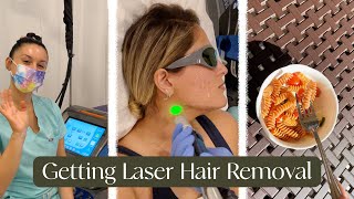 LASER HAIR REMOVAL! 100% PAINLESS?!?! VLOG (MY ACNE/SKIN JOURNEY)