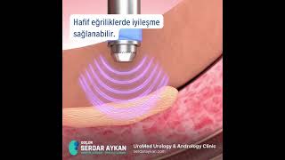 Peyroni̇ Hastaliği, Peyroni̇ Nasil Oluşur. Peyroni̇ Tedavi̇si̇nde Eswt. Doç Dr Serdar Aykan