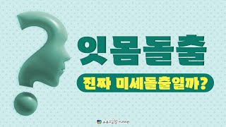 미세돌출, 잇몸돌출 정말 돌출이 미세해서 미세돌출일까?발치하면 합죽이될까? [부산센텀해운대잇몸돌출거미스마일S&amp;S교정치과-뉴욕스마일교정치과]