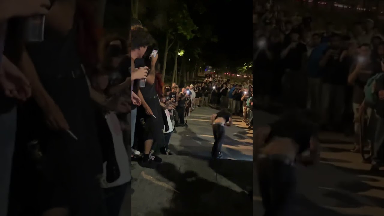 this guy broke his elbow in 6 places 