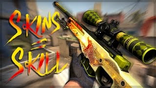 Skins Skill? - Csgo