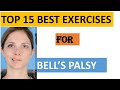 TOP 15 EXERCISES FOR BELL'S PALSY