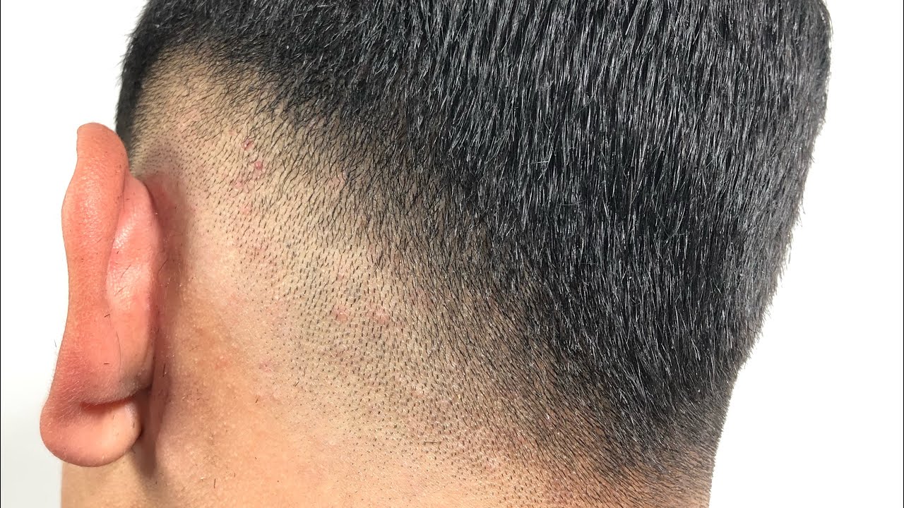 Low fade em V, técnica 2