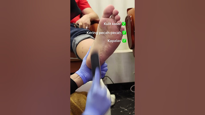 Kulit kering, kapalan dan pecah-pecah beresin sekarang ! #menipedi #thenailshop #pedicure #perawatan