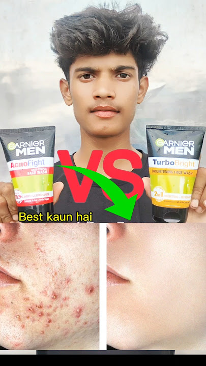 Garnier Men Acno Fight  Face Wash VS Garnier Turbo Bright Face Wash Which is Best || #skincare