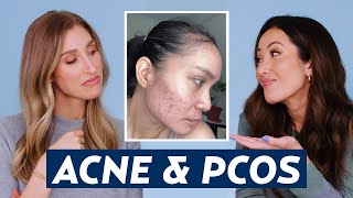Hormonal Acne & Polycystic Ovary Syndrome (PCOS) Skincare Routine for Lala | DERMATOLOGIST REACTS