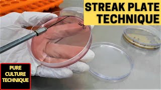 Streak Plate Technique for The Isolation of Pure Culture_A Complete Procedure (Microbiology)