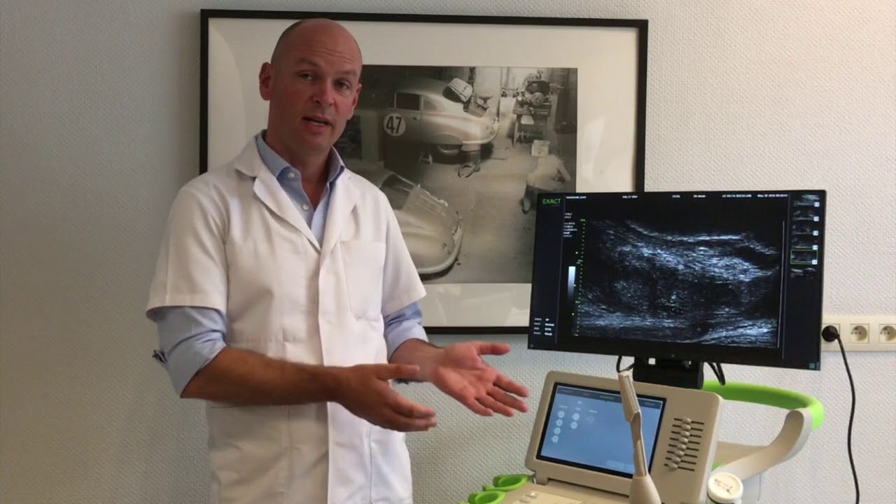 Microultrasound echo prostaat YouTube