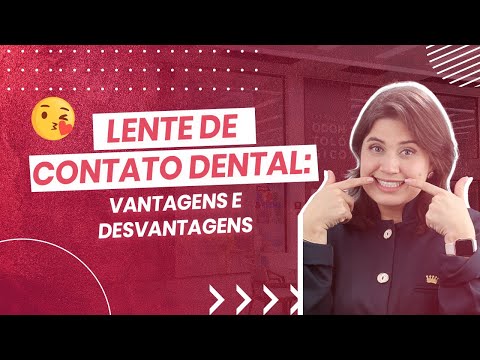 Vídeo: Folheados Dentais - Prós E Contras