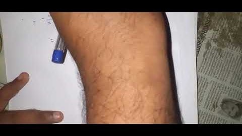 Ideal Bose System Part 2 : Bose Einstein Condensation (Contd)