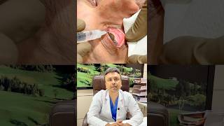 Eye Syringing Explained #eyes #trending #syringing #opthalmology #youtubeshorts