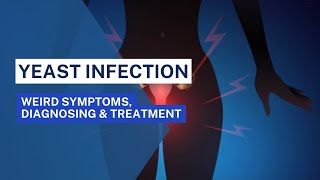 Vaginal yeast infection | weird symptoms, Diagnosing, Treatment