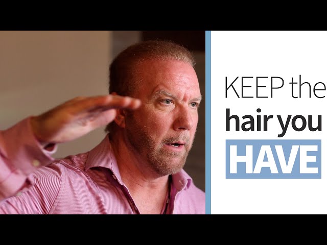 Hair Transplants - Hairline vs. Crown