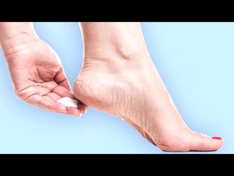 Wideo: Jak leczyć trądzik Aloe Vera: 13 kroków