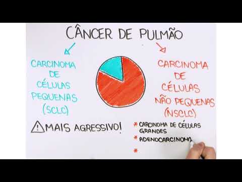 Tudo o que você precisa saber sobre o câncer de pulmão - Parte 1/3