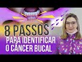 8 passos para identificar o cncer bucal com dra aline manfro