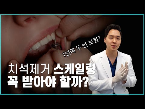 To 아직도 스케일링을 받지 않으시는 분들께 스케일링 가격 스케일링 주기 스케일링 보험 스케일링 후 주의사항 