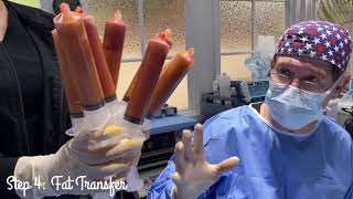 Mommy Makeover ! (SURGERY FOOTAGE) Mommy Makeover ! (SURGERY FOOTAGE)