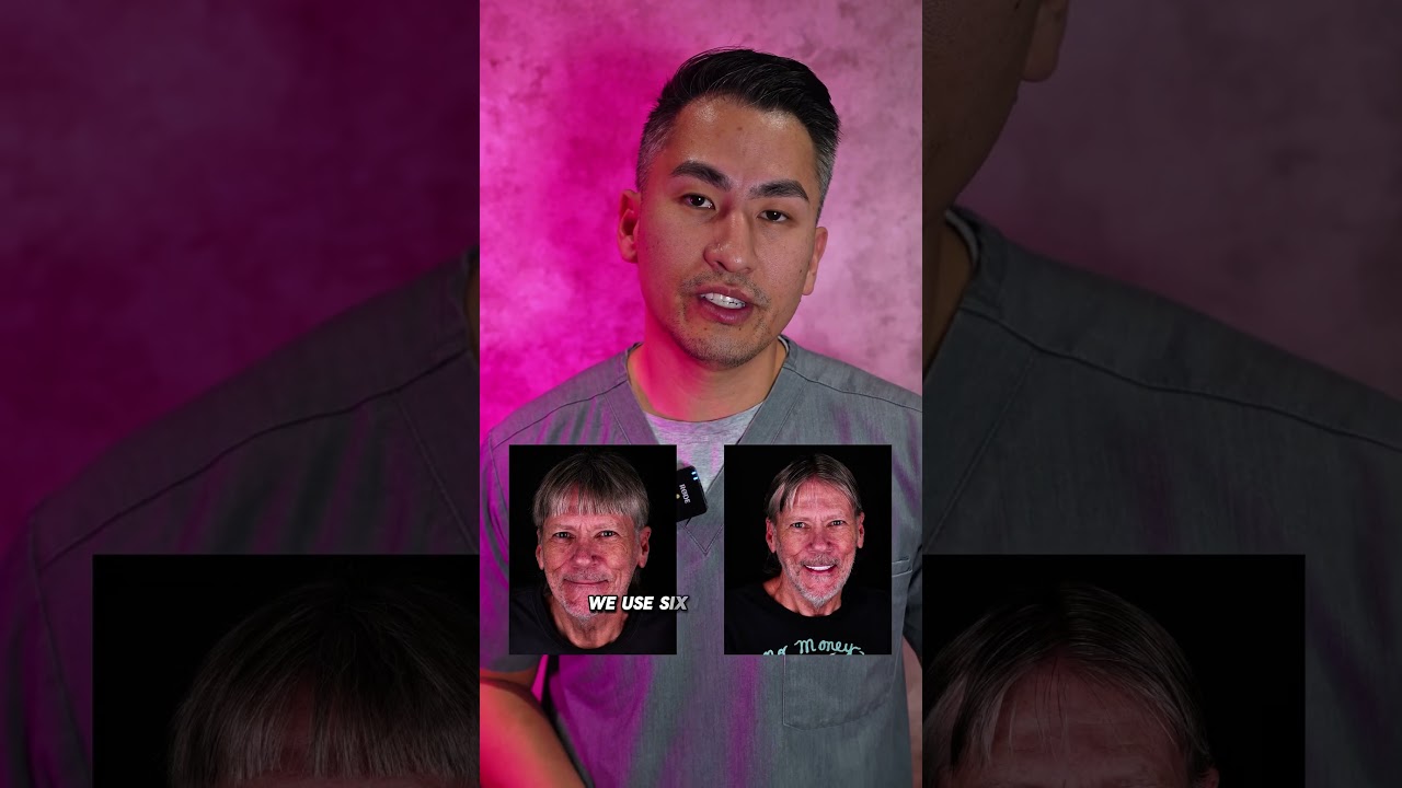 This patient came to us with no teeth… but not just that  