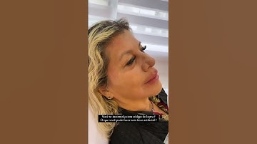 Como melhorar o código de barra naturalmente? #preenchimento #harmonizacao #fiodepdo