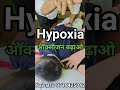बच्चों में ऑक्सीजन की कमी से होने वाली समस्या का समाधान #hypoxia #Hypoxiatreatment #Nawalsir
