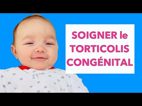 Soigner Le Torticolis Congenital Youtube Soigner Le Torticolis Congenital Youtube