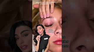 Lash Serum #shorts