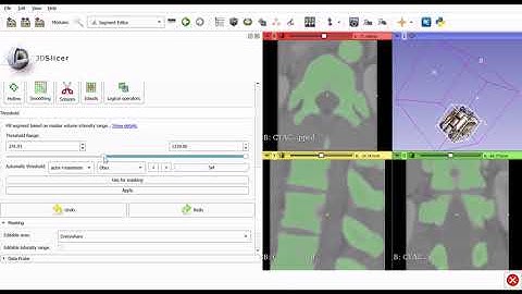 Vertebrae segmentation using 3DSlicer