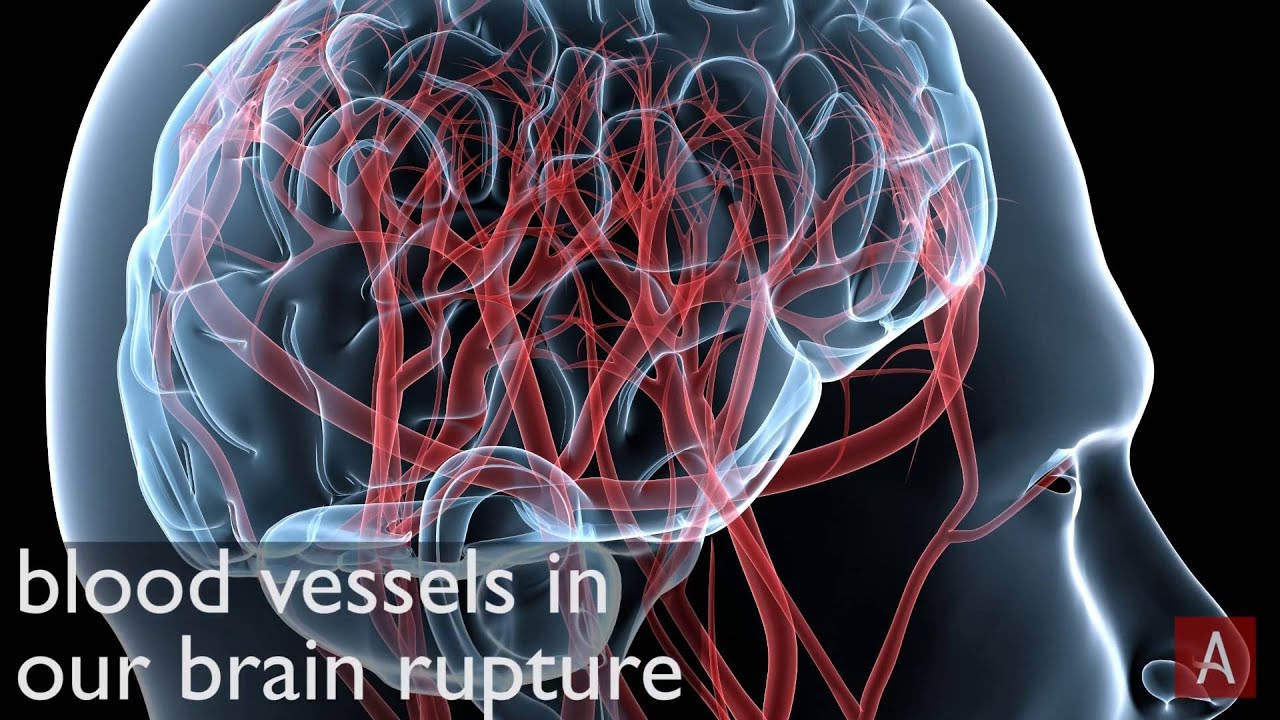 Видео сосудов головного мозга. Повреждение сосудов мозга и сердца. Сосуды головного мозга и шеи. Когнитивный сосуд.