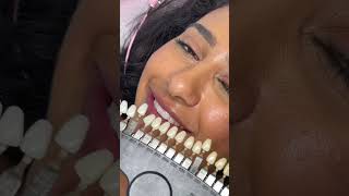 Teeth Whitening Process 🦷 #teethwhiteningprocedure #teethwhiteningbusiness #teethwhiting