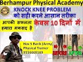 Knock Knee Problem ko sahi karne ka asan tarika....