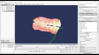 23. Exporting data to exocad