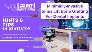 Minimally Invasive Sinus Lift Bone Grafting For Dental Implants