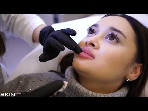 Video: 3 moduri de a reduce umflarea injecției buzelor