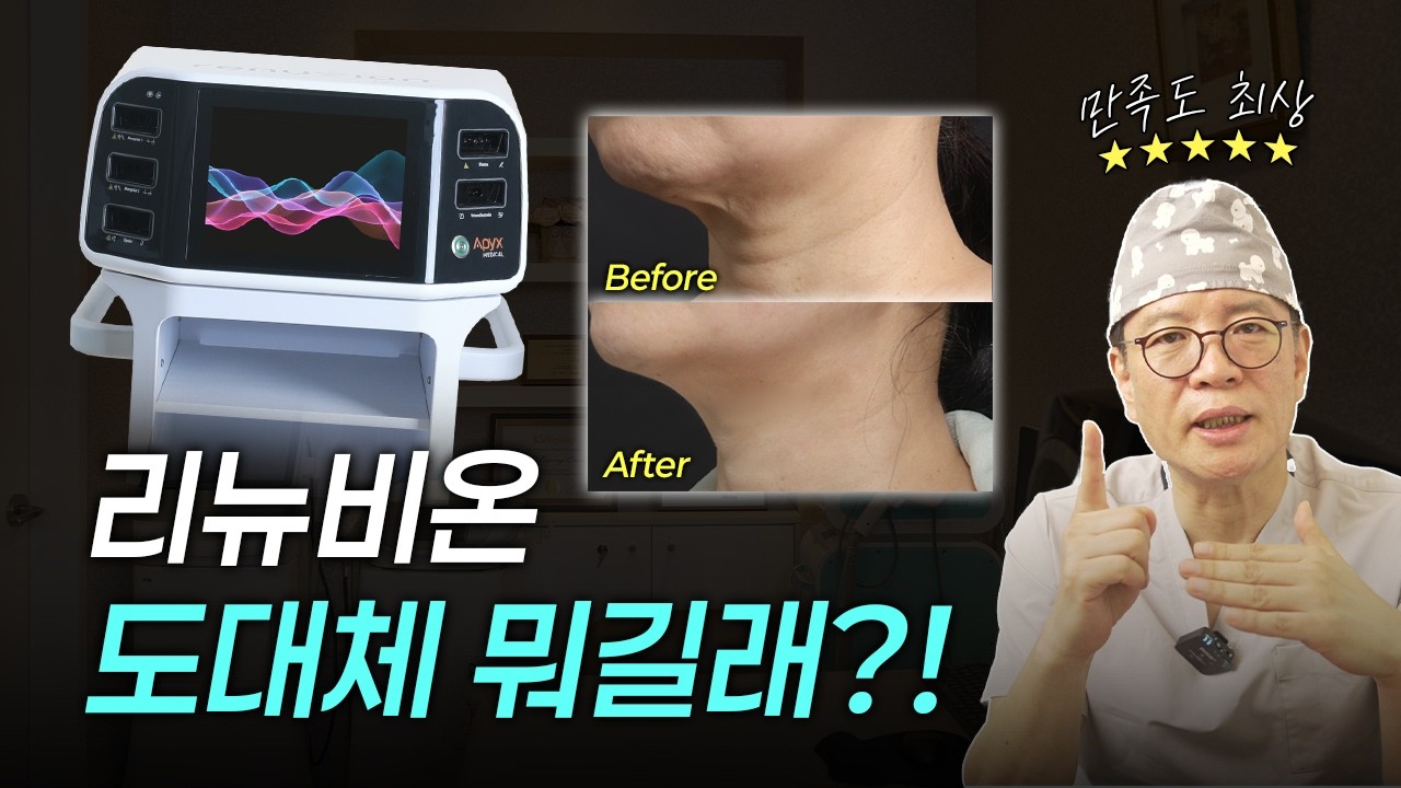 리뉴비온이 도대체 뭐길래?!