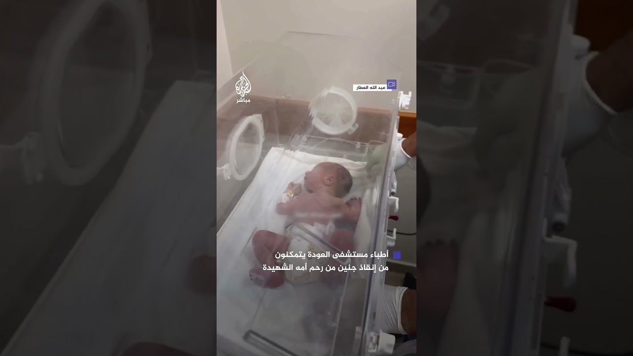 أطباء مستشفى العودة بالنصيرات ينقذون جنينًا من رحم والدته الشهيدة بعد استهداف منزلها في غزة