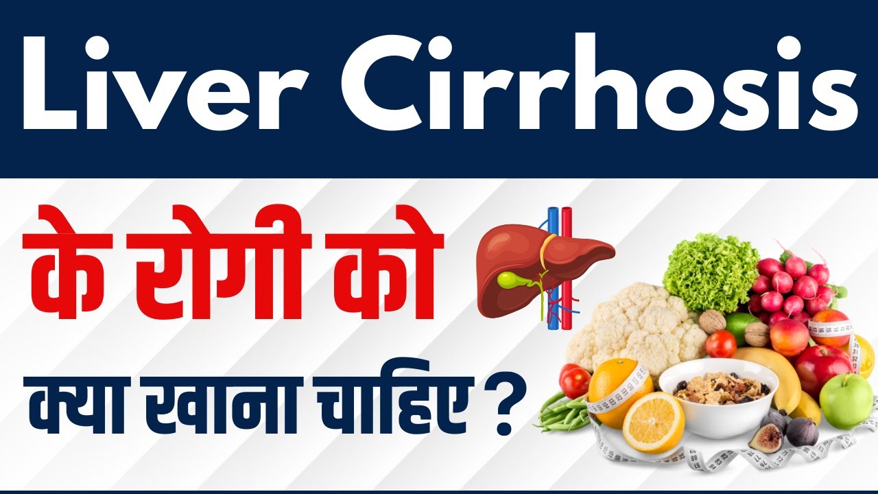 Liver Cirrhosis के रोगी को क्या खाना चाहिए? | Liver Cirrhosis Foods to Eat And Avoid ?