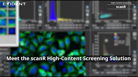 Avi Smith Introduces the scanR High-Content Screening Station