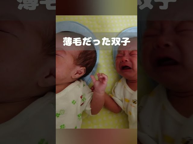 薄毛の赤ちゃんがイケメン になるまで Shorts Youtube