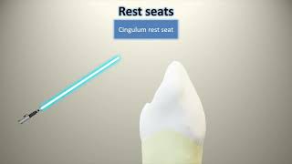 Cingulum rests preparation guidelines