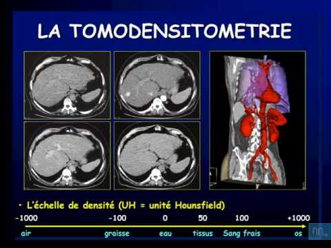 semiologie radiologique partie 3