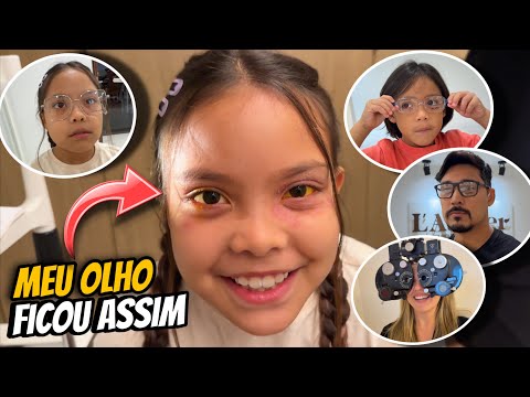 My eye turned yellow! 😱 * Do I need glasses?! 🤓 *