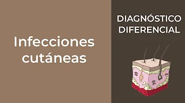 ¿Cuál es la causa más frecuente de las infecciones cutáneas?