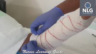 below elbow slab,volar splint/slab,short arm splint,