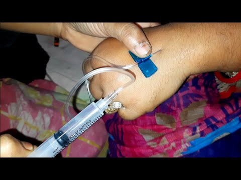 IV Intravenous injection Esomeprazole & Ketorolac Injection Push Ep 99 @Injection Tips