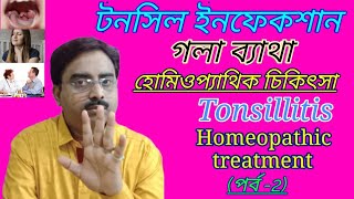 Tonsillitis treatment | tonsils infection | tonsillitis homeopathic treatment in bengali language