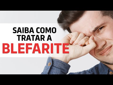 OLHOS COÇANDO? PÁLPEBRA INCHADA? SAIBA COMO TRATAR A BLEFARITE! | LELINHA GENTIL