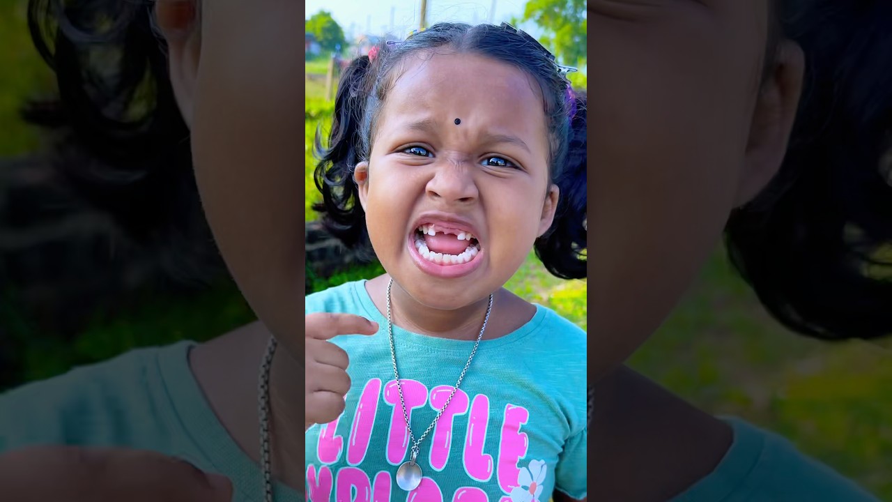 Missing teeth because of squid game 🦷🤪🤣🤗 