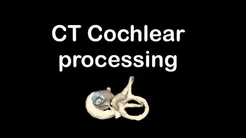 CT cochlear post processing