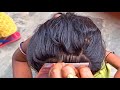 New way to lice picking and combing to clear more lice/AnumyTeluguchannel